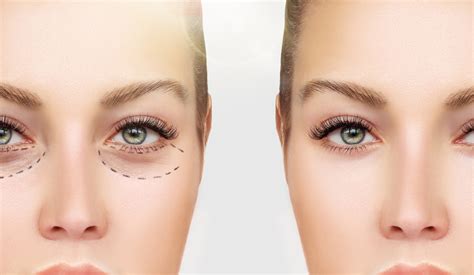 Image result for Pascal OP Surgery