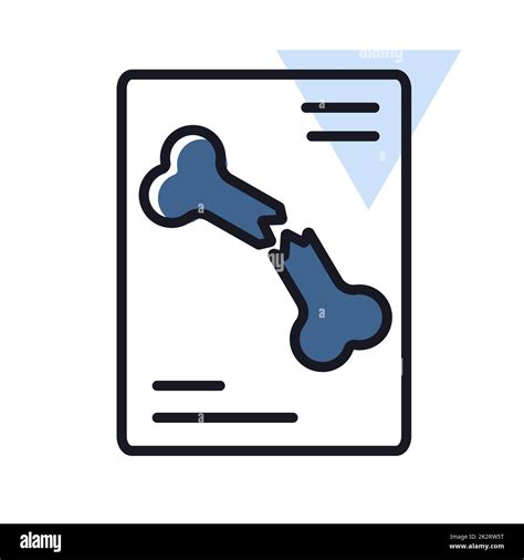 X ray broken bone Banque d'images détourées - Alamy