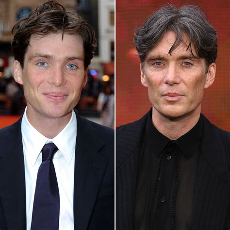 Cillian Murphy Plastic Surgery: Transformation Photos | Life & Style