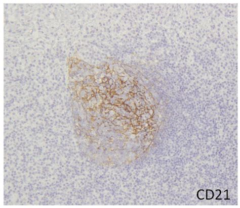 Immuno | Special Issue : Is IgG4-Related Disease a Systemic Autoimmune ...