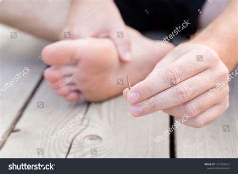 Image result for Splinter in Hand