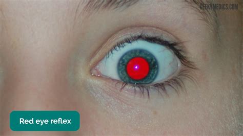 Newborn Baby Assessment (NIPE) - OSCE Guide | Geeky Medics