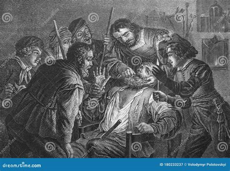 Image result for Medieval Tooth Extraction