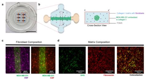 Breast Fibroblasts and ECM Components Modulate Breast Cancer Cell ...