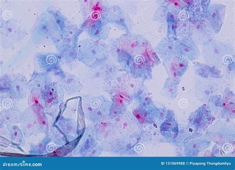 Human Epithelial Cells Under Microscope