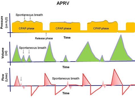 Mechanical ventilation types, indications, complications, settings & modes