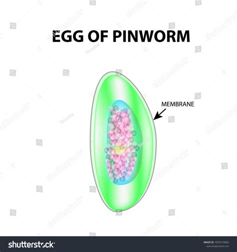 Egg Pinworm Structure Egg Pinworm Infographics Stock Vector (Royalty ...