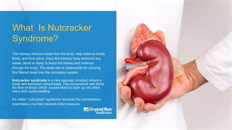 What is Nutcracker Syndrome? | PPTX