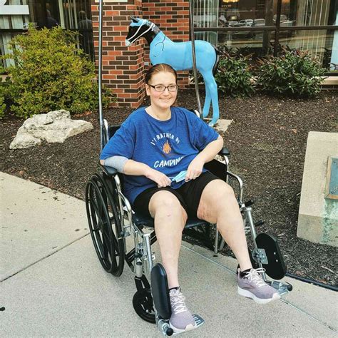 Lexi Reed Lost 217 Lbs. Total Despite Calciphylaxis Diagnosis