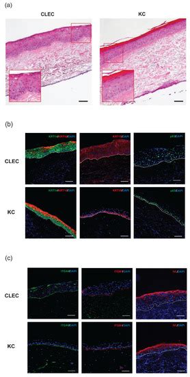 Human Umbilical Cord Lining-Derived Epithelial Cells: A Potential ...