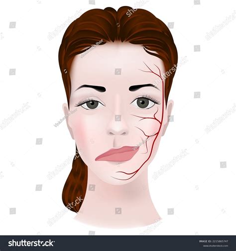29 Myasthenia Gravis Surgery Images, Stock Photos, and Vectors ...