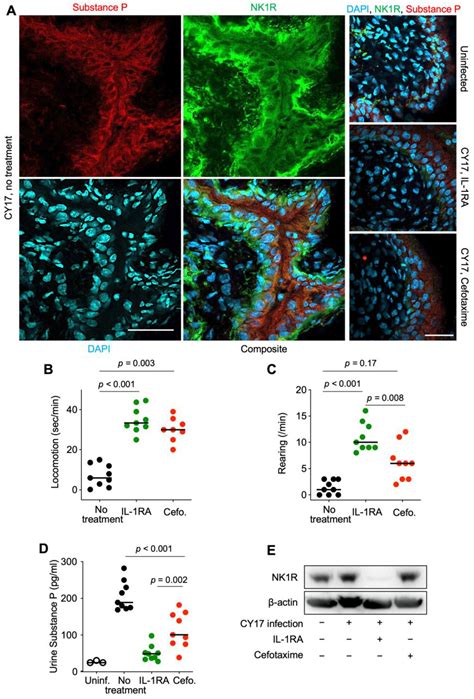 Therapeutic Effects of IL-1RA against Acute Bacterial Infections ...