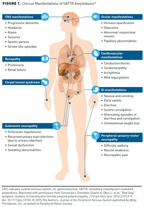 Hereditary ATTR Amyloidosis: Burden of Illness and Diagnostic ...