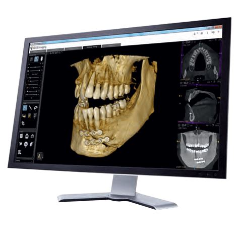 CS 3D imaging software - Linea Diretta