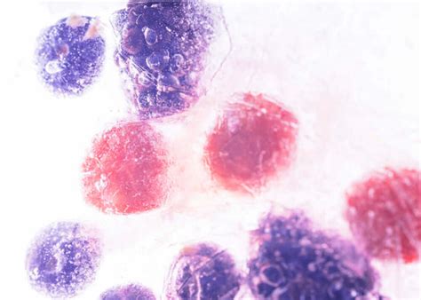 Understanding TLC Normal Range & Importance of Leucocyte Count ...
