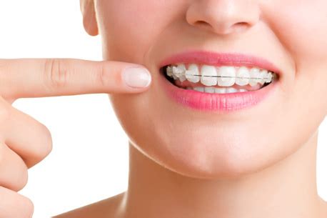 Best Orthodontist in Thane | Orthodontic Treatment Thane, Mumbai