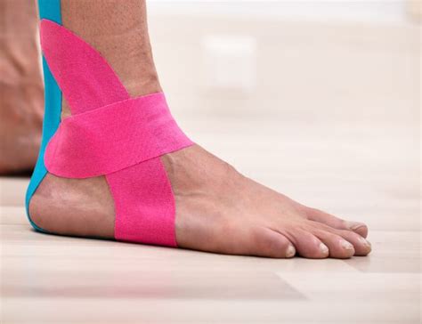 Ankle Sprain Treatment | C7Physio