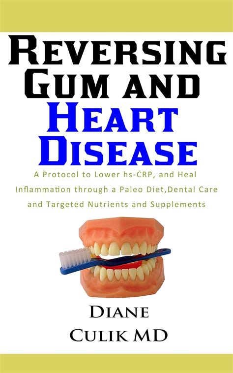 Reversing Gum And Heart Disease: A Protocol to Lower hs-CRP, and Heal ...