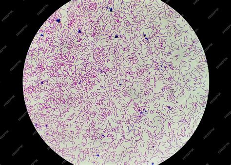 Microscopic view of gram stain showing rod shape escherichia coli or e ...