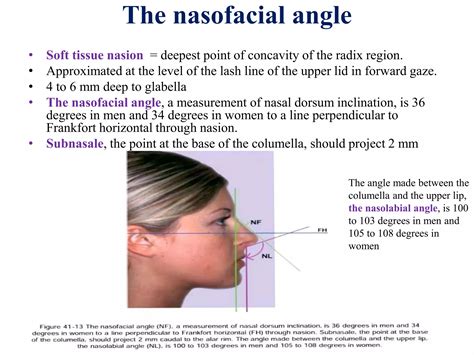 Anthropometry and cephalometric facial analysis | PPTX