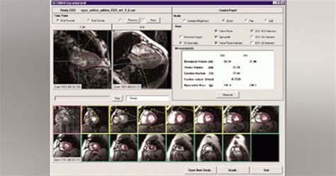 MRI Software Tutorial 的图像结果
