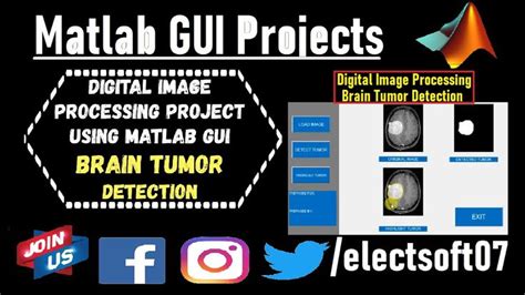 Image result for MATLAB GUI Source Code for Mini Projects