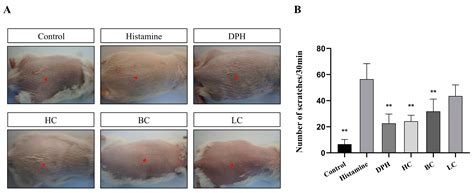 Antibacterial and Antiallergic Effects of Three Tea Extracts on ...