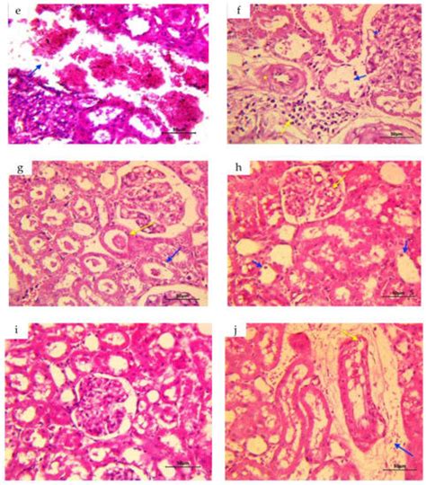 Protective Effect of Quercetin and Ginger (Zingiber officinale) Extract ...