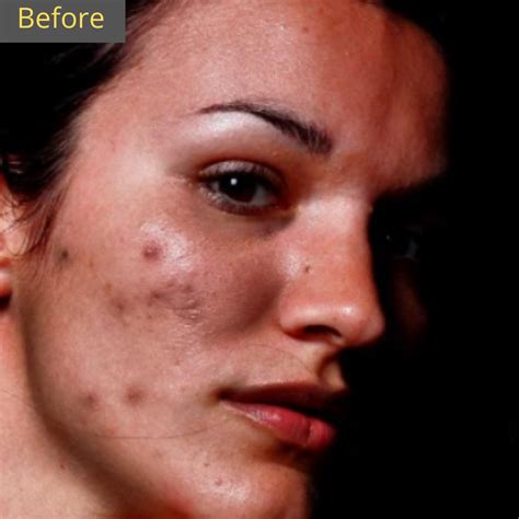 Outsource Photo Editing Services Company in India at Lowest Prices