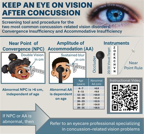 Infographic. Keep an eye on vision after concussion—screening tool and ...