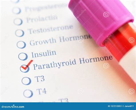 Blood Sample for Parathyroid Hormone Test Stock Image - Image of parathomone, analyzing: 157212051