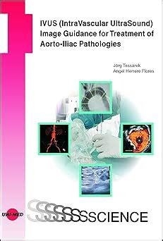 IVUS (IntraVascular UltraSound) Image Guidance for Treatment of Aorto ...