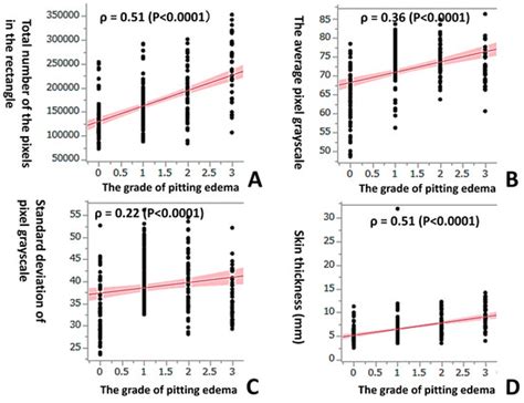 A Histogram Analysis of the Pixel Grayscale (Luminous Intensity) of B ...