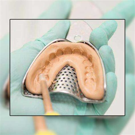 Waldent Rim-Lock Impression Trays – Waldent.com