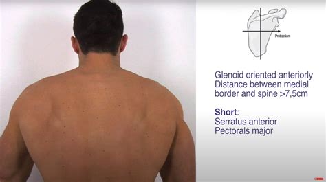 Superior Angle Of Scapula Palpation