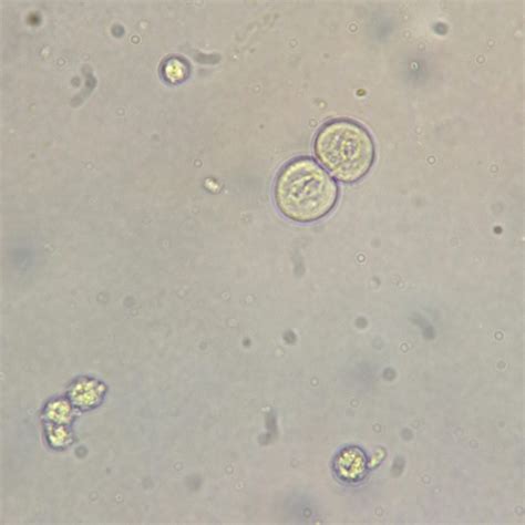 Renal Tubular Epithelial Cells - MedLabBuddy