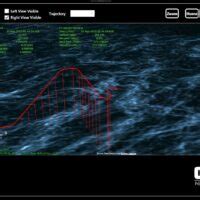 Image result for Navigation System Using IMU
