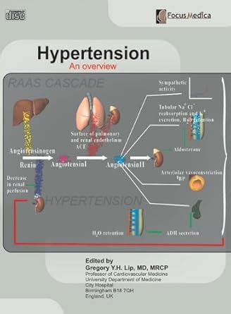 Buy Hypertension: An Overview Book Online at Low Prices in India ...