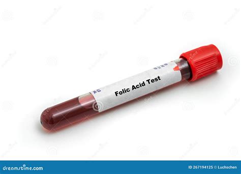 Folic Acid Test Medical Check Up Test Tube with Biological Sample Stock Image - Image of science ...