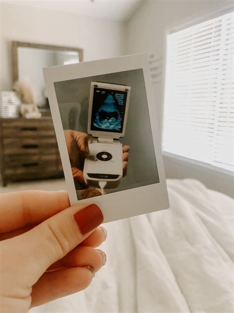 First-Trimester Weeks 的图像结果