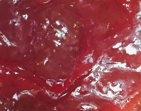 Currant Jelly Sputum