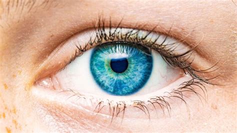 Image result for Colour Vision Deficiency Causes