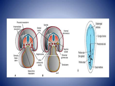 SOLUTION: 7 development of urinary system - Studypool