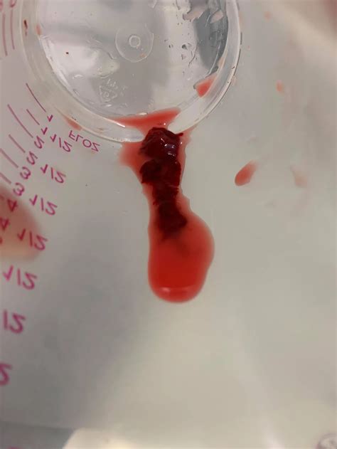 Strawberry Milk and Blood Clots: All the Details — Genuine Lactation