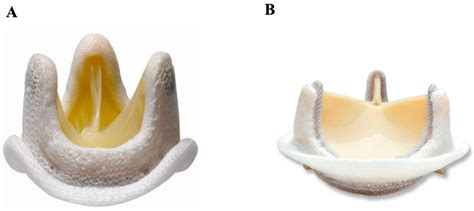 Prosthetic Heart Valves: More than Half a Century of Innovation—An Overview