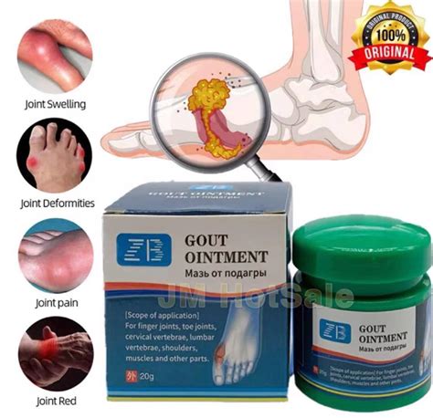 Arthritis Gout Treatment at Anna Crace blog