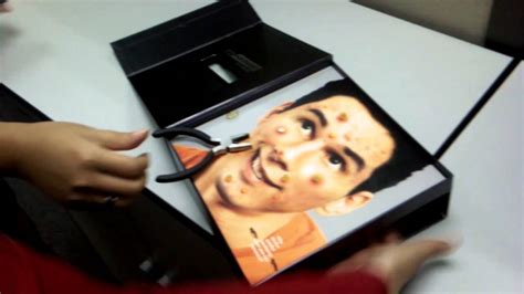 Image result for Worst Exploding Pimple