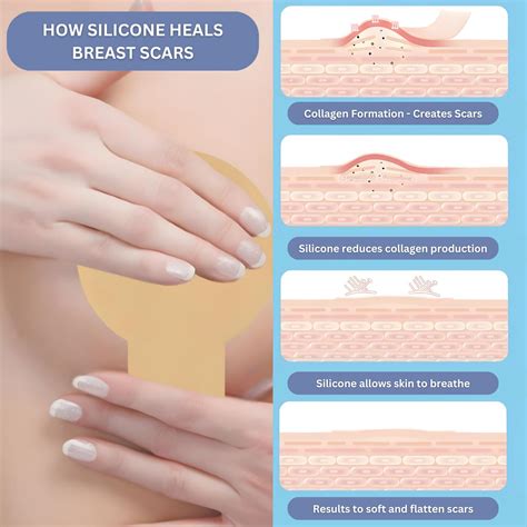 Breast Augmentation Recovery Supplies - Silicone Sheets for Healing - Comfortable Under Post-Op ...
