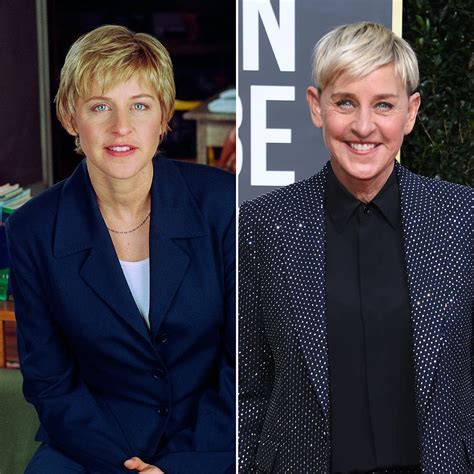 Did Ellen DeGeneres Get Plastic Surgery? Transformation Photos From ...