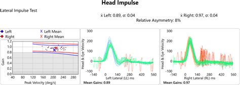 Video head impulse testing: Pitfalls in neurological patients - Journal ...